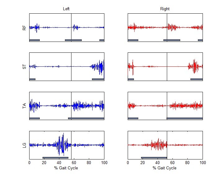 emg graphs